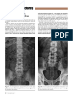 Síndrome de Bertolotti Si Lo Buscas Lo Encuentras Cartas Al Editor Reporte de Caso de Medico Familiar