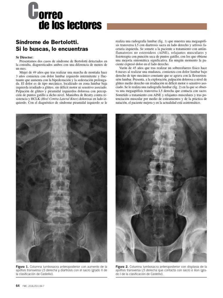 Síndrome de Bertolotti y Megaapófisis L5 | PDF | Especialidades Medicas ...