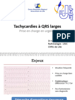 Tachycardies - QRS Larges
