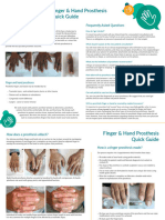 Prosthetic-finger-hand-guide-2021-Medical-Art-Resources