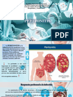 Peritonitis