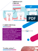 Lesiones Cariosas en Dientes Deciduos