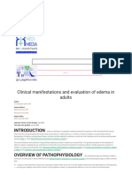 Clinical Manifestations and Evaluation of Edema in Adults