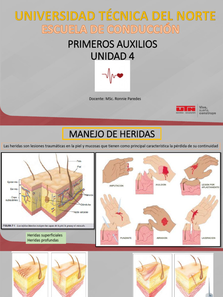 Manejo de Heridas y Quemaduras | PDF | Herida | Quemar