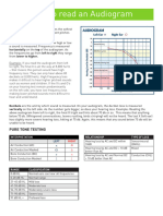 How To Read Audiogram