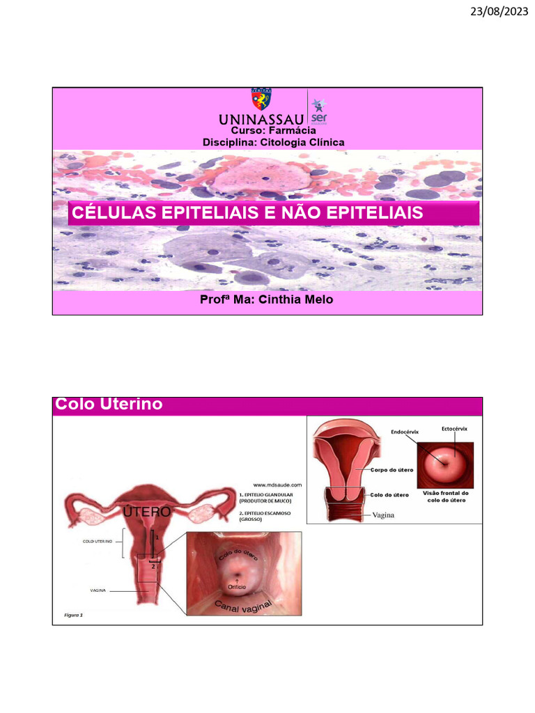 Células Epiteliais e Não Epiteliais no Colo Uterino | PDF | Epitélio ...