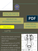 Lecture 15-16. BPH, Stricture Urethra, Varicocele, Spermatocele, Neonatal Hidronefrosis