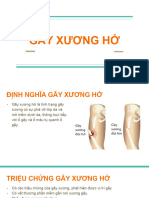 Gãy Xương H