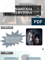 ANOREXIA NERVIOSA