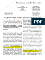 Study_of_Helical_Antenna_as_a_Bone_Fracture_Sensor