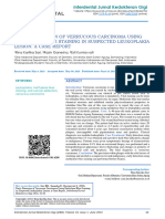 Early Detection of Verrucous Carcinoma Using Methylene Blue Staining in Suspected Leukoplakia Lesion: A Case Report