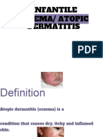 Eczema Atopic