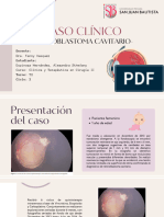 Caso Clínico de Retinoblastoma