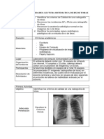 Taller de Simulacion Lectura Sistematica de RX de Torax