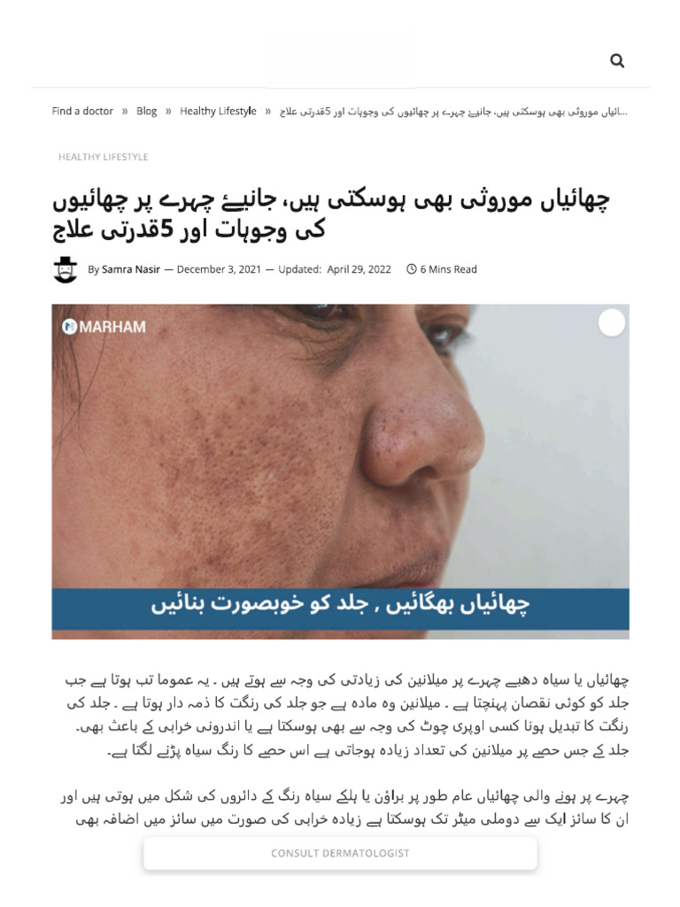Abc 1 | PDF