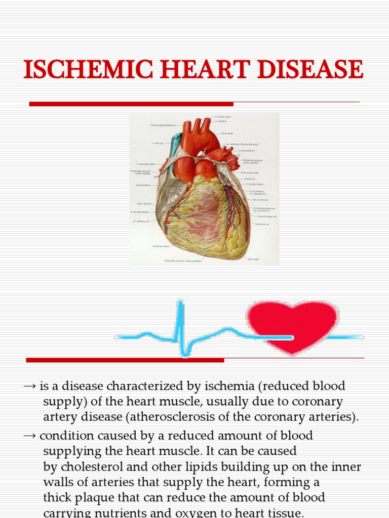 Understanding Ischemic Heart Disease | PDF | Coronary Artery Disease ...
