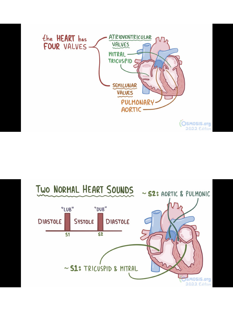 Heart Murmurs Pdf