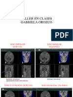 TALLER EN CLASES SENOS PARANASALES