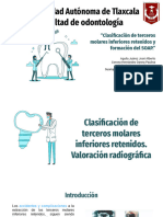 Clasificación de Terceros Molares, SOAP