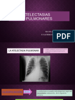 ATELECTASIAS  PULMONARES 2 EXP