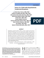 Oral Rehabilitation of A Child With Hypohidrotic Ectodermal Dysplasia