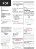 RESUMO - ECG - Arritmias (1)