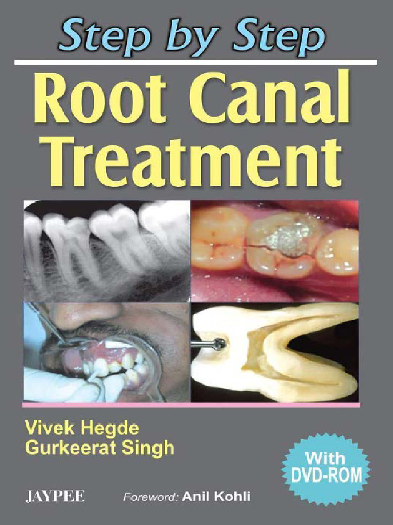 Step by Step Root Canal Treatment PDF Tooth Medical Specialties