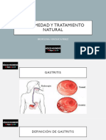 Enfermedad y Tratamiento Natural 17 Act