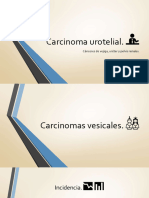 carcinomaurotelial-170518142819