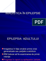 Epilepsia CURS