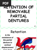 RPD Retention: Direct and Indirect Retainers | PDF | Dentistry Branches