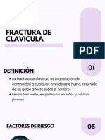 Fractura de Clavícula