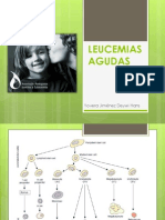 LEUCEMIAS AGUDAS