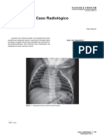 Caso Radiológico