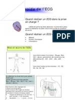 ECG