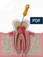 Endodontia 3