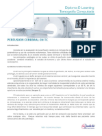 02 Perfusion Cerebral TC