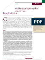 caso radiculitis tbc