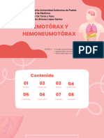 Hemotorax y Hemoneumotorax