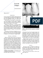 Journal of Periodontology - 1972 - Lang - The Relationship Between The Width of Keratinized Gingiva and Gingival Health