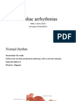 Cardiac arrhythmias