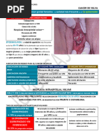 Cancer de Vulva: Ca Vulvar 4to Tipo de Cáncer Genital Femenino. Variedad Más Frecuente