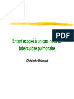 Enfant Exposé À Un Cas Index de Tuberculose Pulmonaire Tuberculose Pulmonaire