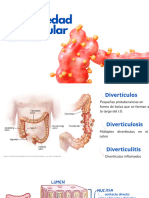 Enf. Diverticular Del Colon