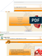Unidad 4 Codigo Infarto