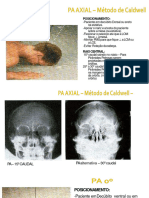 Anatomia Radiologica Do Crânio 2