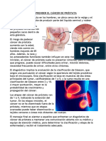 COMPRENDER EL CÁNCER DE PRÓSTATA y Importancia del examen(semiologia)