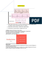 ARRITMIAS (1)