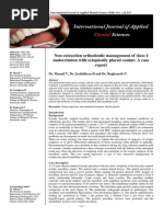 Non Extraction Orthodontic Management of Class I Malocclusion With Ectopically Placed Canine: A Case