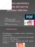 Tecnica para El Nervio Alveolar